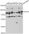 NDC80 Kinetochore Complex Component antibody, LS-C749115, Lifespan Biosciences, Western Blot image 