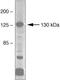 Fms Related Tyrosine Kinase 1 antibody, 36-1100, Invitrogen Antibodies, Western Blot image 