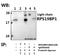 Ribosomal Protein S19 Binding Protein 1 antibody, A11612, Boster Biological Technology, Western Blot image 