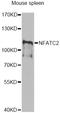 Nuclear Factor Of Activated T Cells 2 antibody, LS-C749201, Lifespan Biosciences, Western Blot image 
