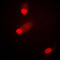 Mitogen-Activated Protein Kinase Kinase 4 antibody, GTX55115, GeneTex, Immunocytochemistry image 