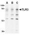 Toll Like Receptor 3 antibody, AP05232PU-N, Origene, Western Blot image 
