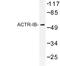 Activin A Receptor Type 1B antibody, LS-C176756, Lifespan Biosciences, Western Blot image 