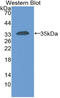 Carcinoembryonic Antigen Related Cell Adhesion Molecule 1 antibody, LS-C314295, Lifespan Biosciences, Western Blot image 