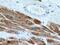 Actin Alpha Cardiac Muscle 1 antibody, 66125-1-Ig, Proteintech Group, Immunohistochemistry paraffin image 