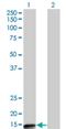 Protein Phosphatase 3 Regulatory Subunit B, Beta antibody, H00005535-M07, Novus Biologicals, Western Blot image 