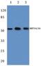 Keratin 14 antibody, PA5-36061, Invitrogen Antibodies, Western Blot image 