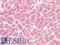 Keratin 18 antibody, LS-B16871, Lifespan Biosciences, Immunohistochemistry paraffin image 