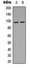 Insulin Receptor antibody, GTX55015, GeneTex, Western Blot image 