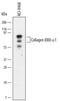 Collagen Type XXIII Alpha 1 Chain antibody, MA5-24188, Invitrogen Antibodies, Western Blot image 