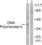 DNA Polymerase Beta antibody, abx013060, Abbexa, Western Blot image 