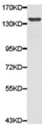 Tyrosine Kinase 2 antibody, TA321570, Origene, Western Blot image 