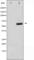 Mitogen-Activated Protein Kinase Kinase Kinase 7 antibody, abx010362, Abbexa, Western Blot image 