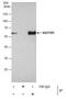 Sequestosome 1 antibody, PA5-27247, Invitrogen Antibodies, Immunoprecipitation image 