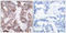 Stathmin 1 antibody, LS-C117489, Lifespan Biosciences, Immunohistochemistry paraffin image 