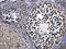 DNA Methyltransferase 3 Alpha antibody, GTX129125, GeneTex, Immunohistochemistry paraffin image 