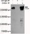 Chromodomain Helicase DNA Binding Protein 4 antibody, STJ99175, St John