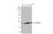 Transgelin antibody, GTX101608, GeneTex, Western Blot image 