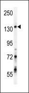 G Protein-Coupled Receptor Associated Sorting Protein 1 antibody, LS-C166644, Lifespan Biosciences, Western Blot image 