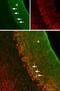 Gamma-Aminobutyric Acid Type A Receptor Alpha3 Subunit antibody, PA5-77402, Invitrogen Antibodies, Immunohistochemistry frozen image 