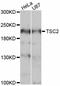 TSC Complex Subunit 2 antibody, A0491, ABclonal Technology, Western Blot image 