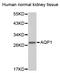 Aquaporin 1 (Colton Blood Group) antibody, STJ112628, St John