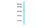 NAD Kinase antibody, A06971, Boster Biological Technology, Western Blot image 