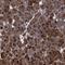 ATP Binding Cassette Subfamily F Member 2 antibody, HPA021815, Atlas Antibodies, Immunohistochemistry paraffin image 