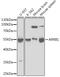 Arrestin Beta 1 antibody, A0998, ABclonal Technology, Western Blot image 