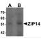 Solute Carrier Family 39 Member 14 antibody, MBS151580, MyBioSource, Western Blot image 