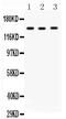 Angiotensin I Converting Enzyme antibody, PA2196-1, Boster Biological Technology, Western Blot image 