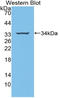 Signal Transducing Adaptor Molecule antibody, LS-C314799, Lifespan Biosciences, Western Blot image 