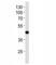 Absent In Melanoma 2 antibody, F52335-0.4ML, NSJ Bioreagents, Western Blot image 