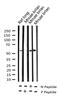 Checkpoint Kinase 2 antibody, GTX03351, GeneTex, Western Blot image 