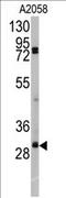 Snail2 antibody, AP11931PU-N, Origene, Western Blot image 