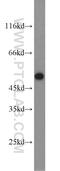 Adiponectin Receptor 2 antibody, 14361-1-AP, Proteintech Group, Western Blot image 