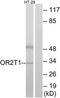 Olfactory Receptor Family 2 Subfamily T Member 1 antibody, TA315346, Origene, Western Blot image 