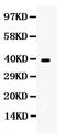 Wnt Family Member 7A antibody, RP1088, Boster Biological Technology, Western Blot image 