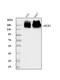 ATP Binding Cassette Subfamily B Member 1 antibody, A00049-5, Boster Biological Technology, Western Blot image 