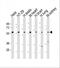 ETV1 antibody, M01383-1, Boster Biological Technology, Western Blot image 