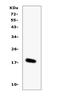 Interleukin 16 antibody, A01635, Boster Biological Technology, Western Blot image 