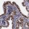 ERH MRNA Splicing And Mitosis Factor antibody, NBP1-84976, Novus Biologicals, Immunohistochemistry paraffin image 