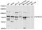 Sodium Channel Epithelial 1 Delta Subunit antibody, abx126515, Abbexa, Western Blot image 