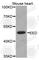 Polycomb protein EED antibody, A5371, ABclonal Technology, Western Blot image 