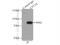 Carnitine Palmitoyltransferase 1A antibody, 66039-1-Ig, Proteintech Group, Immunoprecipitation image 
