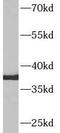 Aquaporin-9 antibody, FNab09925, FineTest, Western Blot image 