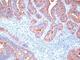 Carcinoembryonic Antigen Related Cell Adhesion Molecule 5 antibody, V2450IHC-7ML, NSJ Bioreagents, Immunohistochemistry paraffin image 