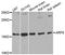 ADP Ribosylation Factor 6 antibody, A0988, ABclonal Technology, Western Blot image 