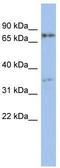 EOMES antibody, TA343539, Origene, Western Blot image 