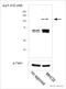 ABL Proto-Oncogene 1, Non-Receptor Tyrosine Kinase antibody, ab47315, Abcam, Western Blot image 